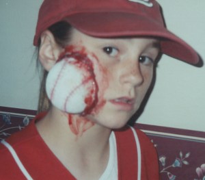 11-injured baseball player